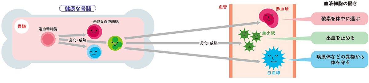 膠原病のひとつ